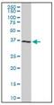 Cyclin Dependent Kinase 6 antibody, AM31156PU-N, Origene, Western Blot image 