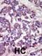 Large Tumor Suppressor Kinase 1 antibody, abx033135, Abbexa, Immunohistochemistry frozen image 
