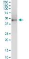 Keratin 81 antibody, H00003887-D01P, Novus Biologicals, Western Blot image 