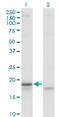 Corticotropin Releasing Hormone antibody, LS-C196964, Lifespan Biosciences, Western Blot image 