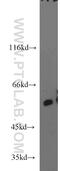 Arylsulfatase A antibody, 19061-1-AP, Proteintech Group, Western Blot image 