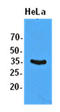 Eukaryotic Translation Initiation Factor 2 Subunit Alpha antibody, LS-B6273, Lifespan Biosciences, Western Blot image 
