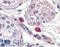 FceRIa antibody, LS-B3150, Lifespan Biosciences, Immunohistochemistry paraffin image 