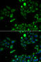 Ubiquinol-Cytochrome C Reductase, Rieske Iron-Sulfur Polypeptide 1 antibody, STJ28867, St John