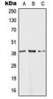 Hydroxycarboxylic Acid Receptor 1 antibody, MBS821939, MyBioSource, Western Blot image 