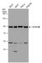 Signal Transducer And Activator Of Transcription 5B antibody, GTX132113, GeneTex, Western Blot image 