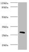 Carbonic Anhydrase 1 antibody, A53734-100, Epigentek, Western Blot image 