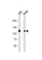 MutS Homolog 2 antibody, abx034997, Abbexa, Western Blot image 