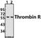 Coagulation Factor II Thrombin Receptor antibody, A03352S42, Boster Biological Technology, Western Blot image 