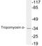 Tropomyosin 1 antibody, LS-C200034, Lifespan Biosciences, Western Blot image 