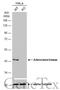 ADK antibody, GTX101372, GeneTex, Western Blot image 