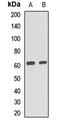 Scavenger Receptor Class B Member 1 antibody, LS-C668386, Lifespan Biosciences, Western Blot image 