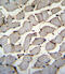 DExD/H-Box 60 Like antibody, 55-936, ProSci, Immunohistochemistry paraffin image 