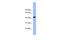 Actin Related Protein 3 antibody, NBP1-56406, Novus Biologicals, Western Blot image 