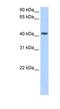 Pregnancy Specific Beta-1-Glycoprotein 5 antibody, NBP1-57973, Novus Biologicals, Western Blot image 