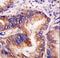 Eukaryotic Translation Initiation Factor 2 Alpha Kinase 1 antibody, LS-C101223, Lifespan Biosciences, Immunohistochemistry paraffin image 