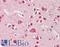 Serine/Threonine Kinase 39 antibody, LS-B8310, Lifespan Biosciences, Immunohistochemistry frozen image 