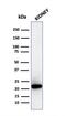 Ferritin Light Chain antibody, GTX02642, GeneTex, Western Blot image 