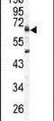 Arylsulfatase B antibody, PA5-14368, Invitrogen Antibodies, Western Blot image 