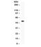 Fc Fragment Of IgG Receptor And Transporter antibody, R32263, NSJ Bioreagents, Western Blot image 