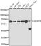 Zinc Finger CCCH-Type Containing 15 antibody, GTX65585, GeneTex, Western Blot image 