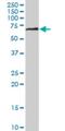 Dihydropyrimidinase Like 5 antibody, H00056896-M04, Novus Biologicals, Western Blot image 