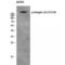 Integrin Subunit Beta 4 antibody, LS-C381351, Lifespan Biosciences, Western Blot image 