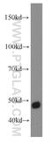 Thyroid Hormone Receptor Interactor 13 antibody, 19602-1-AP, Proteintech Group, Western Blot image 