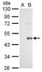 Wnt Family Member 3A antibody, GTX128101, GeneTex, Western Blot image 