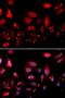 Rac GTPase Activating Protein 1 antibody, LS-C333966, Lifespan Biosciences, Immunofluorescence image 