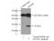 Glutathione S-Transferase Mu 5 antibody, 14502-1-AP, Proteintech Group, Immunoprecipitation image 