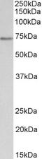 Cell Division Cycle 6 antibody, STJ72204, St John