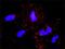 ABL Proto-Oncogene 2, Non-Receptor Tyrosine Kinase antibody, H00000027-M03, Novus Biologicals, Proximity Ligation Assay image 