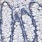 Asialoglycoprotein Receptor 1 antibody, PA5-52885, Invitrogen Antibodies, Immunohistochemistry frozen image 