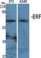 ETS2 Repressor Factor antibody, A03411, Boster Biological Technology, Western Blot image 