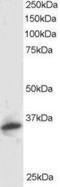 Proteasome Inhibitor Subunit 1 antibody, PA5-18133, Invitrogen Antibodies, Western Blot image 