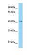 Vacuolar Protein Sorting 36 Homolog antibody, orb330896, Biorbyt, Western Blot image 