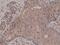 SMAD Family Member 4 antibody, NBP2-61587, Novus Biologicals, Immunohistochemistry paraffin image 