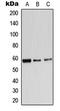 Adrenoceptor Alpha 1B antibody, MBS820380, MyBioSource, Western Blot image 