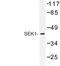 Mitogen-Activated Protein Kinase Kinase 4 antibody, LS-C176909, Lifespan Biosciences, Western Blot image 