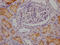 Angiotensin I Converting Enzyme antibody, CSB-RA268157A0HU, Cusabio, Immunohistochemistry paraffin image 