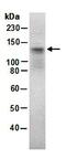 HECT Domain E3 Ubiquitin Protein Ligase 1 antibody, orb67186, Biorbyt, Western Blot image 