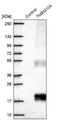 Transmembrane Protein 104 antibody, NBP1-92515, Novus Biologicals, Western Blot image 