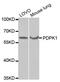 3-Phosphoinositide Dependent Protein Kinase 1 antibody, MBS126559, MyBioSource, Western Blot image 