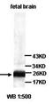 Syntaxin Binding Protein 6 antibody, orb77063, Biorbyt, Western Blot image 