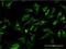 Microtubule Associated Protein 1A antibody, H00064112-M02, Novus Biologicals, Immunocytochemistry image 