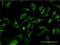 Microtubule-associated protein 1A antibody, H00064112-M02, Novus Biologicals, Immunocytochemistry image 