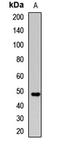 Acid Phosphatase, Prostate antibody, LS-C668436, Lifespan Biosciences, Western Blot image 