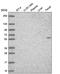 Terminal Nucleotidyltransferase 2 antibody, PA5-65876, Invitrogen Antibodies, Western Blot image 