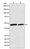 Citrate Synthase antibody, M05128, Boster Biological Technology, Western Blot image 